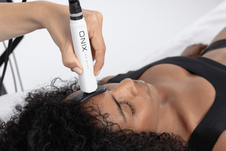 Onix RadioFrecuencia